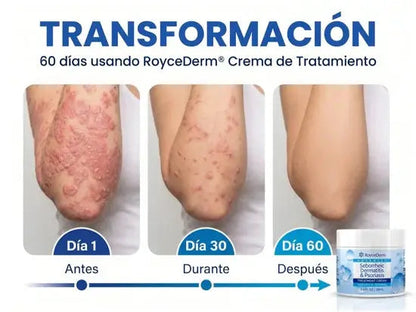 Transformación en 60 días: día 1, día 30 y día 60