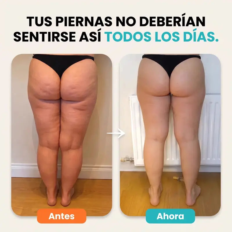 Tus piernas no deberían sentirse así todos los días: antes y ahora