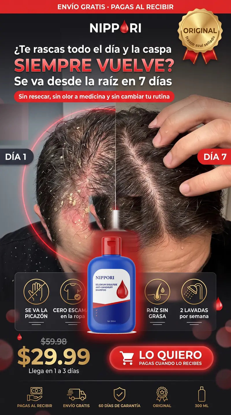 Te rascas todo el dia y la caspa siempre vuelve. Se va desde la raiz en 7 dias. Sin resecar, sin olor a medicina y sin cambiar tu rutina. Nippori original, 300 ml, 29.99 dolares, pagas al recibir